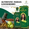 Dabur Amla Hair Oil for Healthy Hair and Moisturized Scalp, Indian Hair Oil for Men and Women 300ml (Pack of 6)