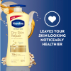 Vaseline Intensive Care Body Lotion Dry Skin Repair 625ml - Set of 3 Pcs